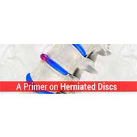 A Primer on Herniated Discs | Orange County Pain Clinics