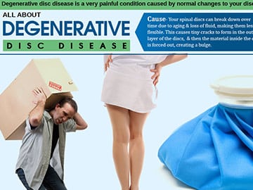 All-About-Degenerative-Disc-Disease
