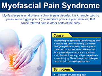 Myofascial-Pain-Syndrome-by-Orange-County-Pain-Clinics-thumb