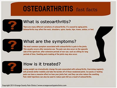 Osteoarthritis-by-Orange-County-Pain-Clinics-IG2