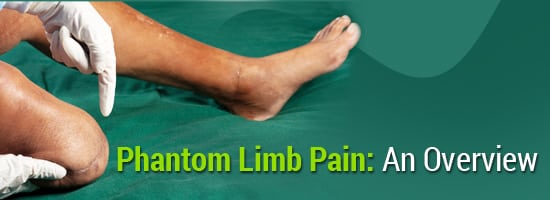 Phantom-Limb-Pain-An-Overview