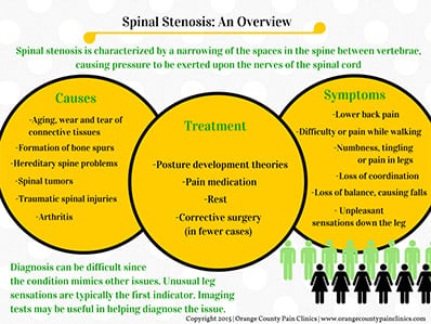 Spinal-Stenosis-by-Orange-County-Pain-Clinics1