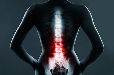 Spinal-Decompression-in-Mission-Viejo-Orange-County-Pain-Clinics